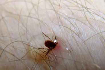 Tick warning issued as Cowal heads outdoors